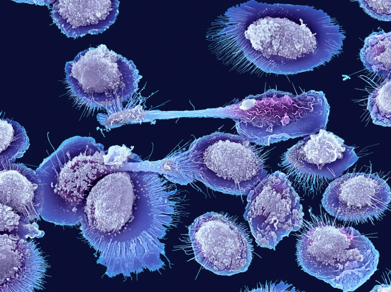 科学家发现了衰老过程中炎症激增的原因